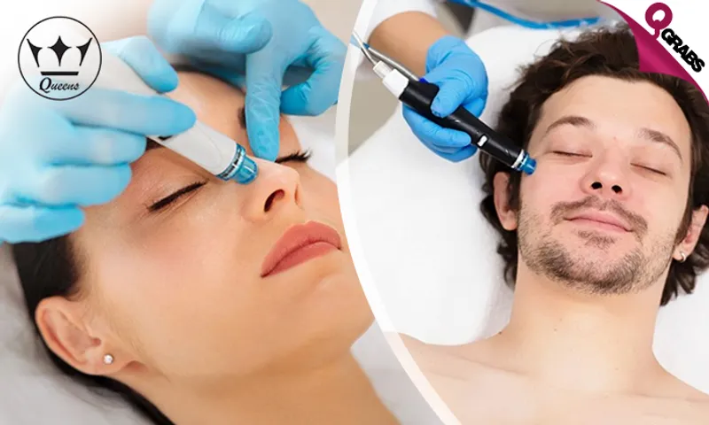 Premium HydraFacial Session for Ladies & Men!